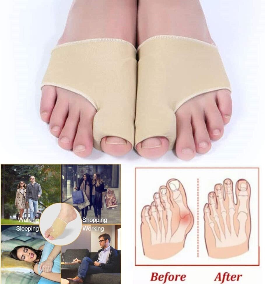 Big Toe Bunion Corrector Splint Straightener Valgus Pain Relief  Big Bone Orthopedic Bunion Correction Pedicure Socks Silicone Corrector Braces Toes Separator Feet Care Tool